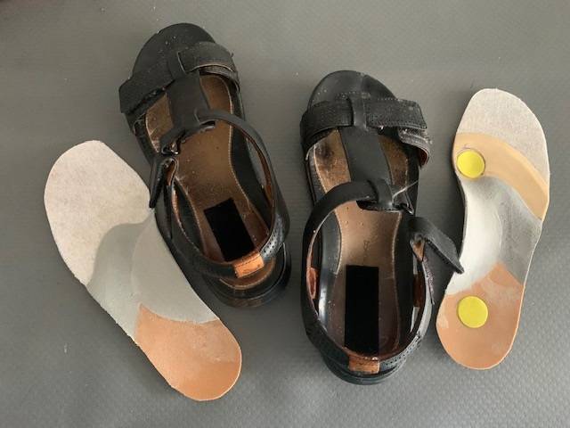 Semelles orthopédiques (orthèses plantaires) fabriquées sur mesure pour être portées dans des chaussures ouvertes, en été, à Marseille (13011 13012 13013)