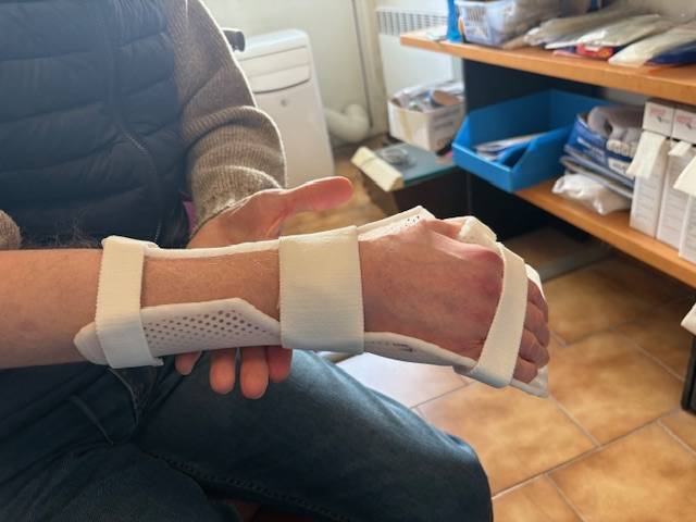 Orthèse thermoformée sur mesure pour main spastique après hémiplégie à Allauch (proche de 13011 13012 13013)