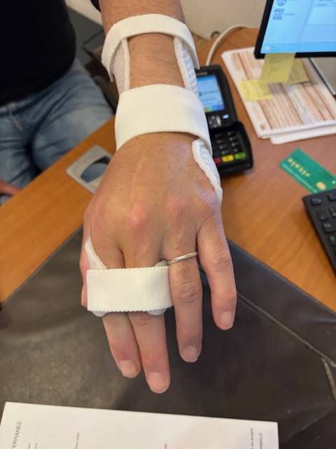 Où faire réaliser une orthèse thermoformée de la main sur mesure proche de Marseille 13011 13012 13013