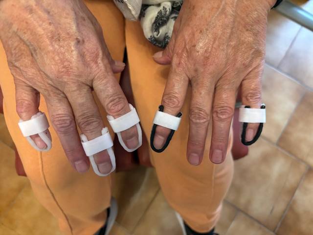 Orthèses digitales thermoformées pour soulager l’arthrose des doigts à Allauch et Marseille