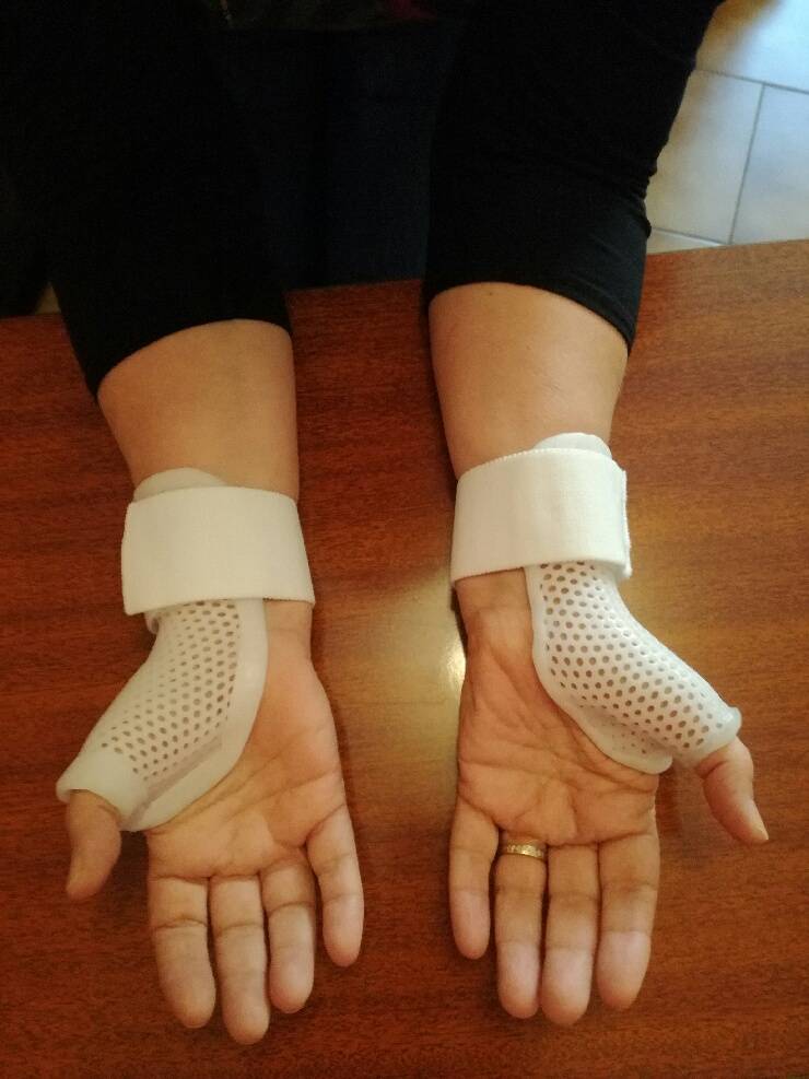 orthèses de pouce pour rhizarthrose