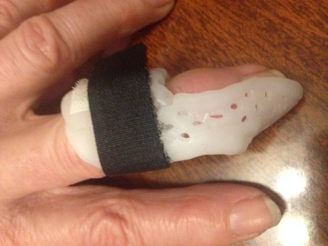 orthèse digitale pour déviation de la dernière phalange