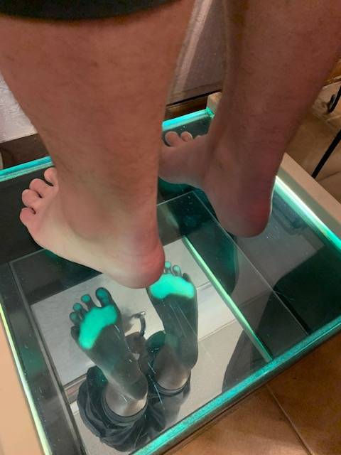 Photo 1 : pied équin Semelles orthopédiques pour pieds en équin fabrication sur mesure à Allauch proche de Marseille (13011 13012 13013)