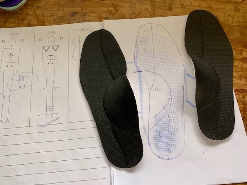 Génu valgum chez l’adolescent – jambes en X – traitement orthopédique avec des semelles sur mesure réalisées à Allauch proche de Marseille.