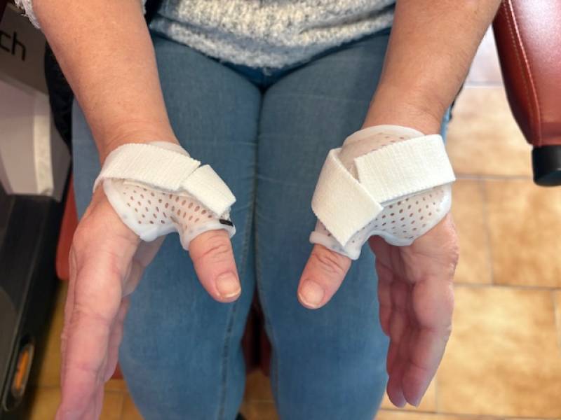 Soulager la rhizarthrose avec des orthèses thermoformées du pouce sur mesure à Allauch, proche Marseille 13011 13012 13013