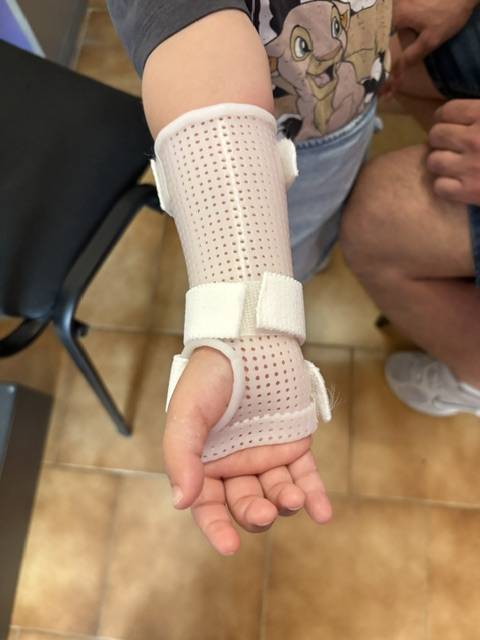 Orthèse thermoformée pédiatrique après fracture en motte de beurre du radius à Marseille