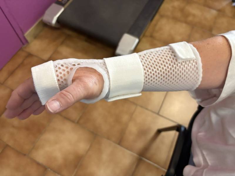 Orthèse thermoformée pour syndrome du canal carpien à Allauch : soulager les douleurs nocturnes durablement