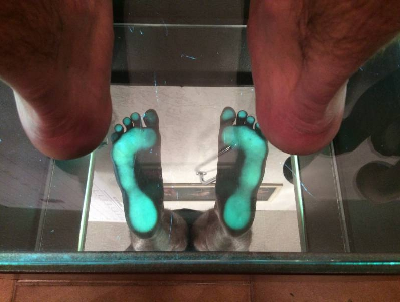 Etude des appuis plantaires au Podoscope