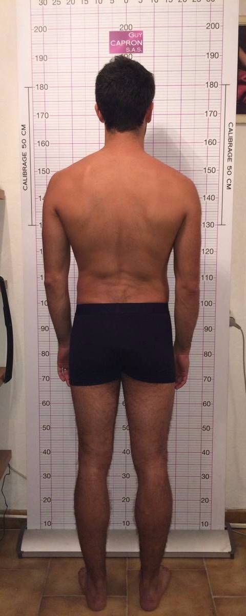 bilan postural réalisé dans notre cabinet à Allauch