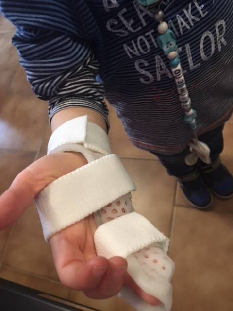 Orthèse Pédiatrique pour fracture du cinquième os Métacarpien - Marseille