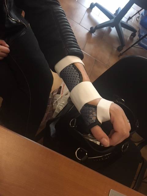 spécialiste des orthèses thermoformées pour fracture en motte de beurre à Allauch et Château-Gombert