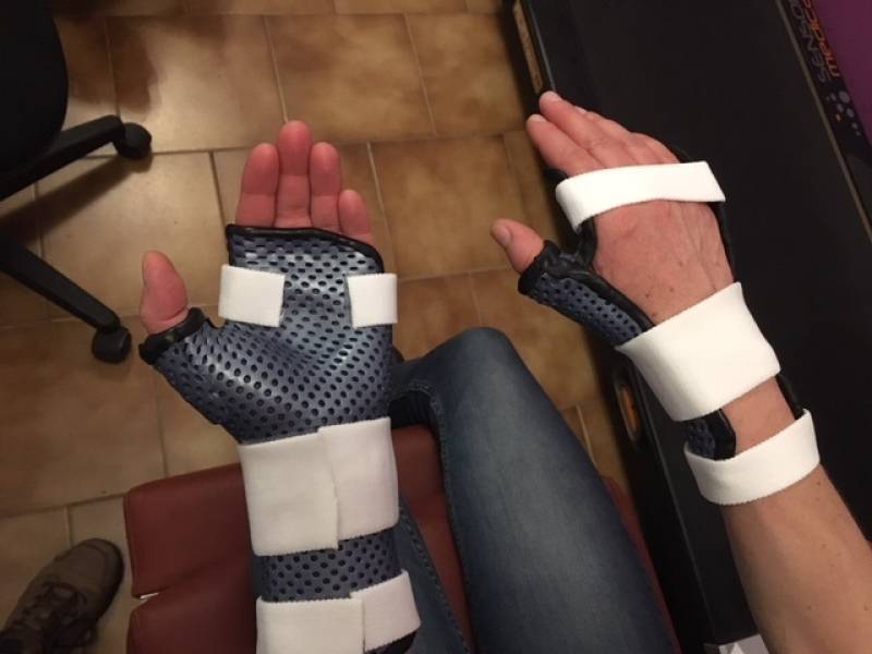 Orthèse pour soigner le syndrome du canal carpien sans opération - Marseille