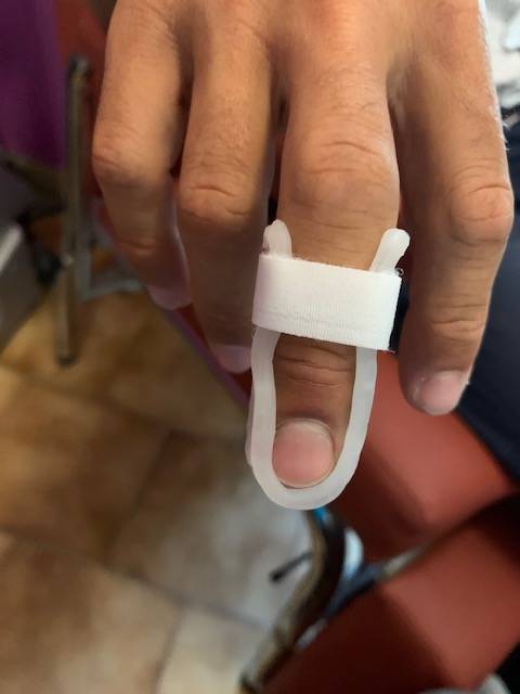 Orthèse digitale thermoformée pour fracture de la phalange distale du majeur à Allauch (proche de la Valentine)