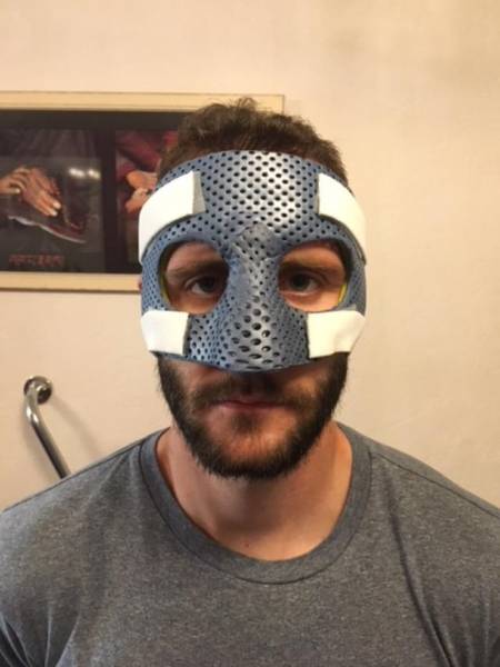 Réalisation d'un masque de protection pour fracture du nez (orthèse faciale  sur mesure) pour sportif professionnel à Allauch Marseille - Centre de  l'Orthopédie et du Bien-être à Marseille - Centre de l'Orthopédie