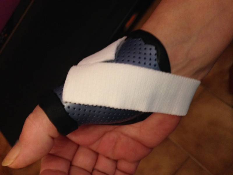 Orthèse de pouce sur mesure thermoformée pour rhizarthrose - Allauch