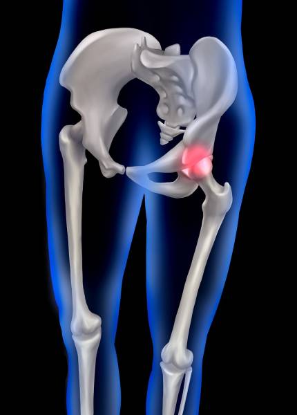 Arthrologie de la hanche : cours de podologie pour étudiants en orthopédie, orthèse et podologie à Allauch