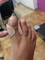 Notre zone d'activité pour ce service Trouver un spécialiste pour la pose de l'orthoplastie sur orteils chez l'adulte à Plan-de-Cuques dans les Bouches-du-Rhône