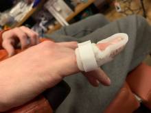 Notre zone d'activité pour ce service Consultation chez un orthopédiste orthésiste podologiste à Allauch dans les Bouches-du-Rhône