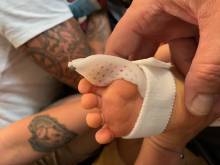 Notre zone d'activité pour ce service Fabrication et vente d'orthèses thermoformées près de Marseille 13011