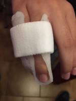 Notre zone d'activité pour ce service Trouver des semelles orthopédiques pour course à pied adaptées à la foulée à Marseille 13008