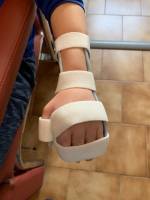 Notre zone d'activité pour ce service Acheter des orthèses plantaires thermoformées à proximité de La Destrousse dans le 13